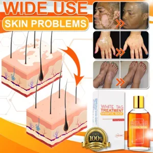 White Tag Treatment Essential Serum