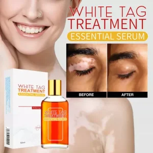White Tag Treatment Essential Serum