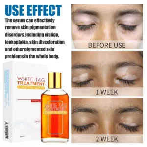 White Tag Treatment Essential Serum