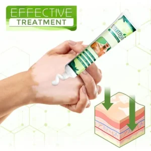 White Tag Treatment Moisturizing Cream