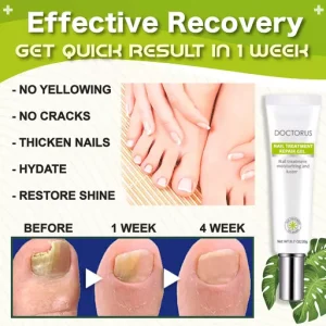 Health Toe Instant Beauty Gel