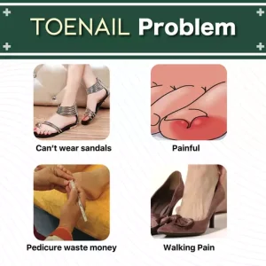 Health Toe Instant Beauty Gel